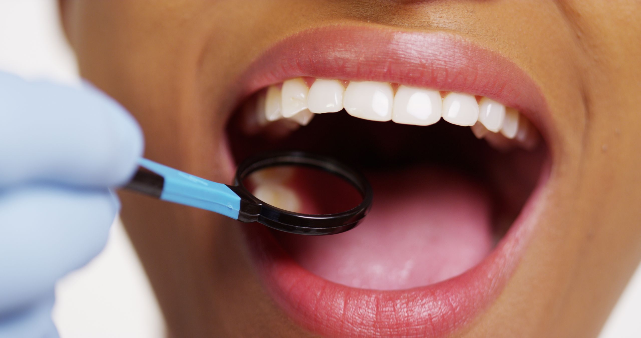 Dentist examining a patient for gum disease treatment in Houston