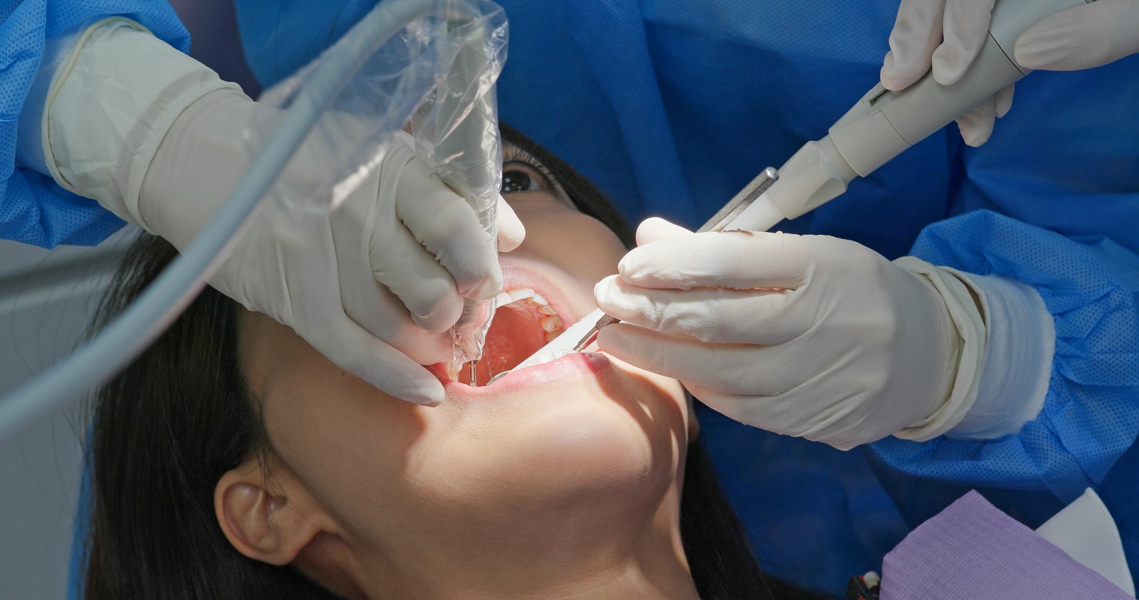 Dentist and patient discussing root canal treatment options at a Houston dental office
