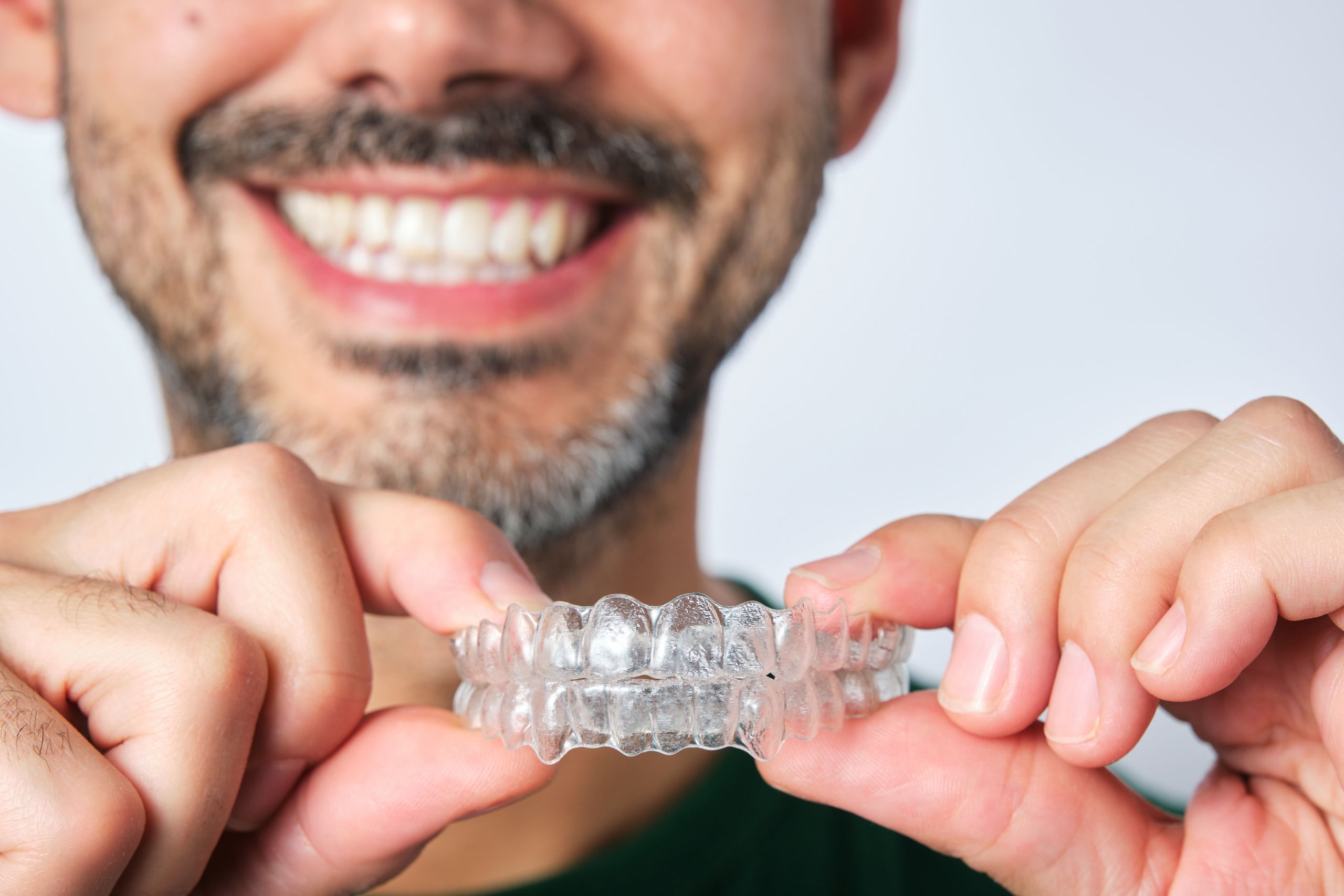 Woman inserting clear aligner tray for orthodontic treatment